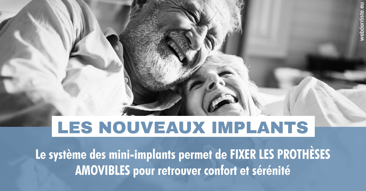 https://www.wilm-dentiste.fr/Les nouveaux implants 2