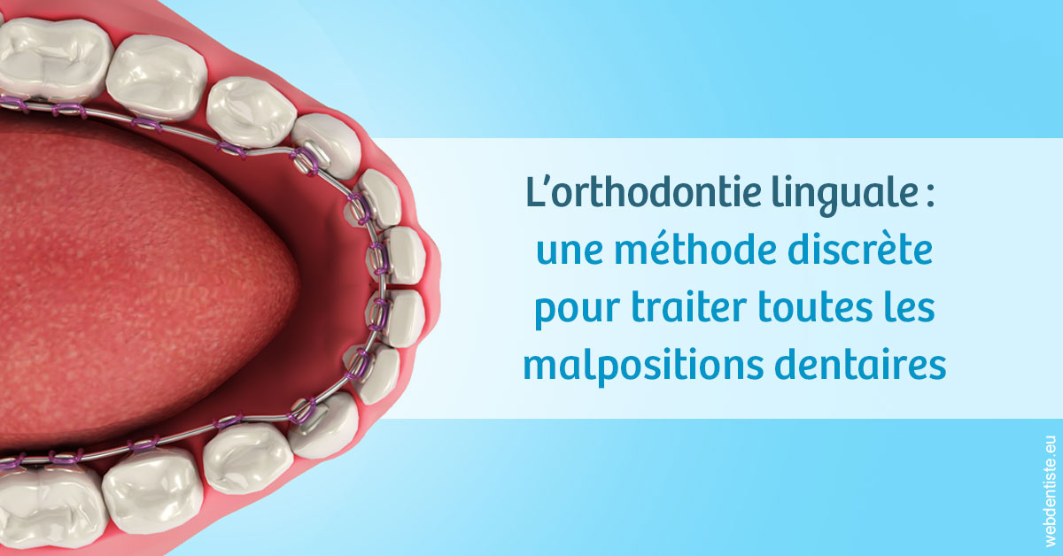 https://www.wilm-dentiste.fr/L'orthodontie linguale 1