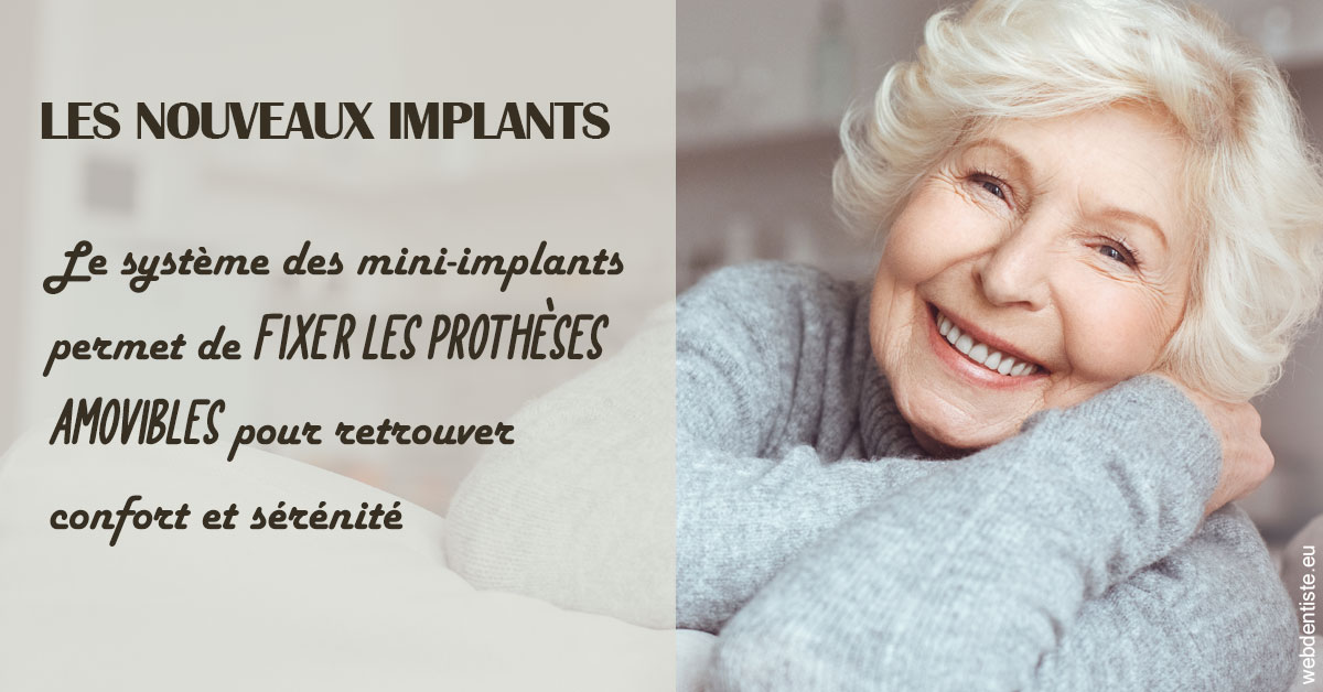 https://www.wilm-dentiste.fr/Les nouveaux implants 1