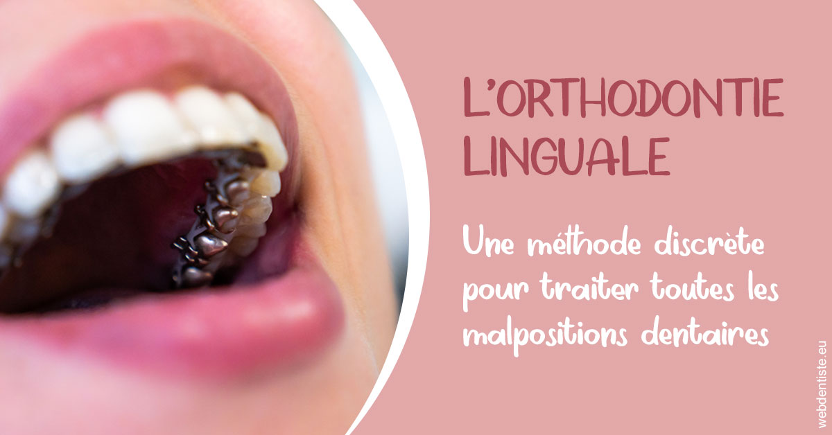 https://www.wilm-dentiste.fr/L'orthodontie linguale 2