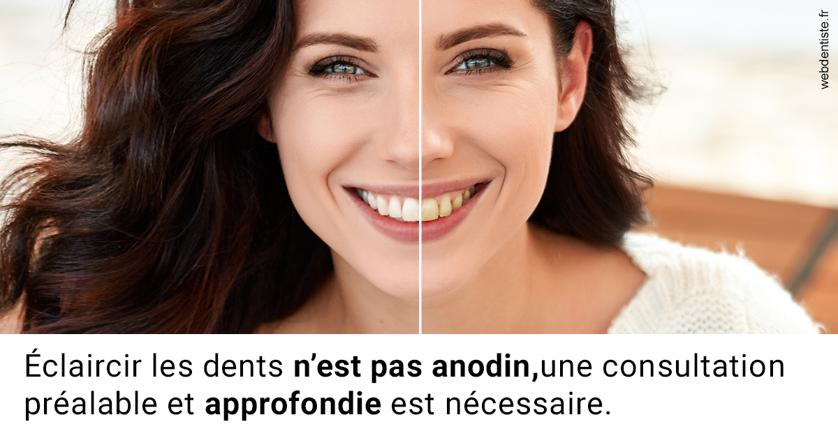 https://www.wilm-dentiste.fr/Le blanchiment 2