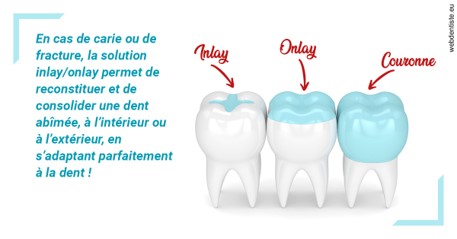 https://www.wilm-dentiste.fr/L'INLAY ou l'ONLAY