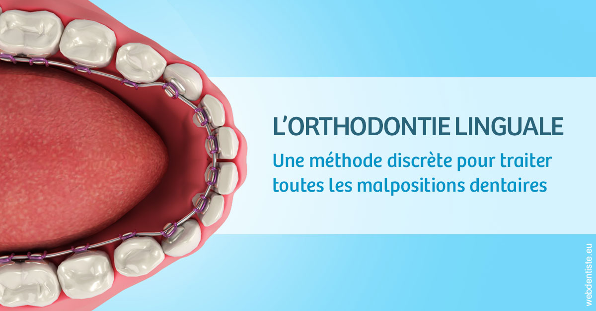 https://www.wilm-dentiste.fr/L'orthodontie linguale 1