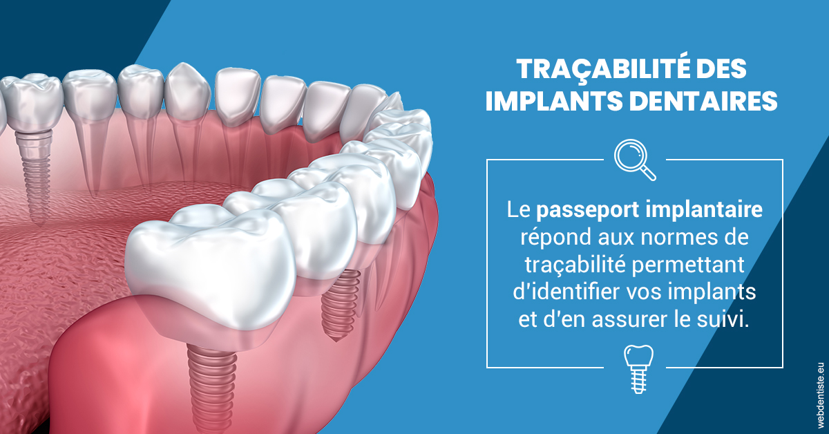 https://www.wilm-dentiste.fr/T2 2023 - Traçabilité des implants 1