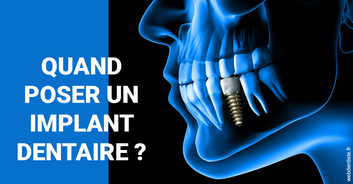 https://www.wilm-dentiste.fr/Les implants 1