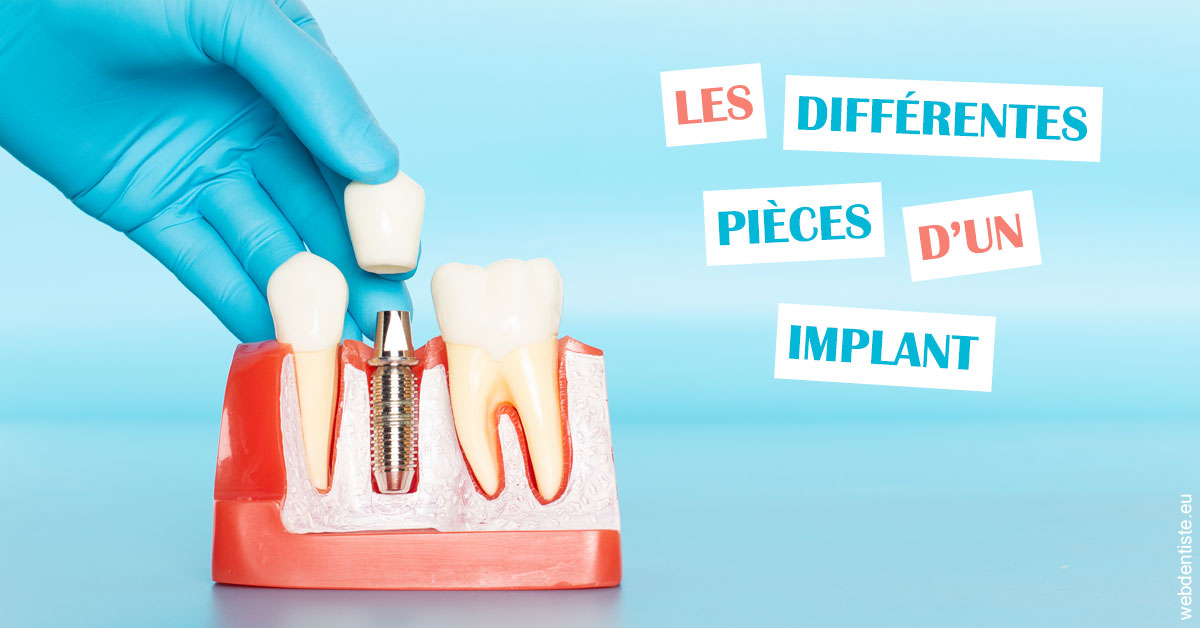 https://www.wilm-dentiste.fr/Les différentes pièces d’un implant 2