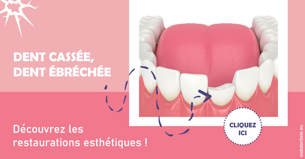 https://www.wilm-dentiste.fr/Dent cassée ébréchée 1