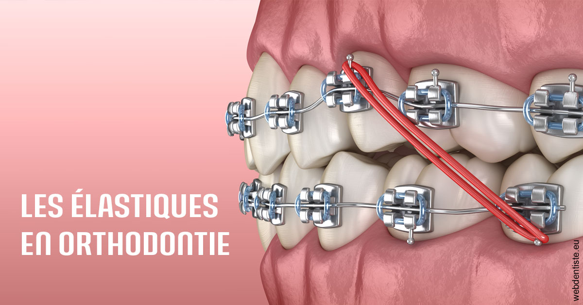 https://www.wilm-dentiste.fr/Elastiques orthodontie 2