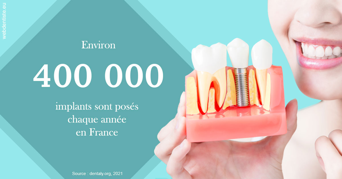 https://www.wilm-dentiste.fr/Pose d'implants en France 2