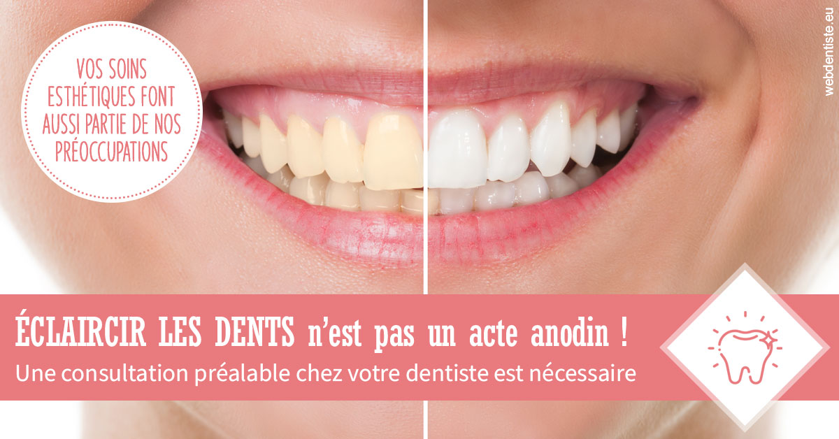 https://www.wilm-dentiste.fr/Eclaircir les dents 1