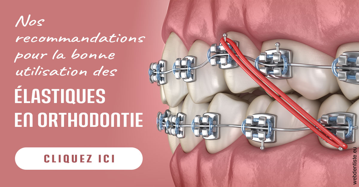 https://www.wilm-dentiste.fr/Elastiques orthodontie 2