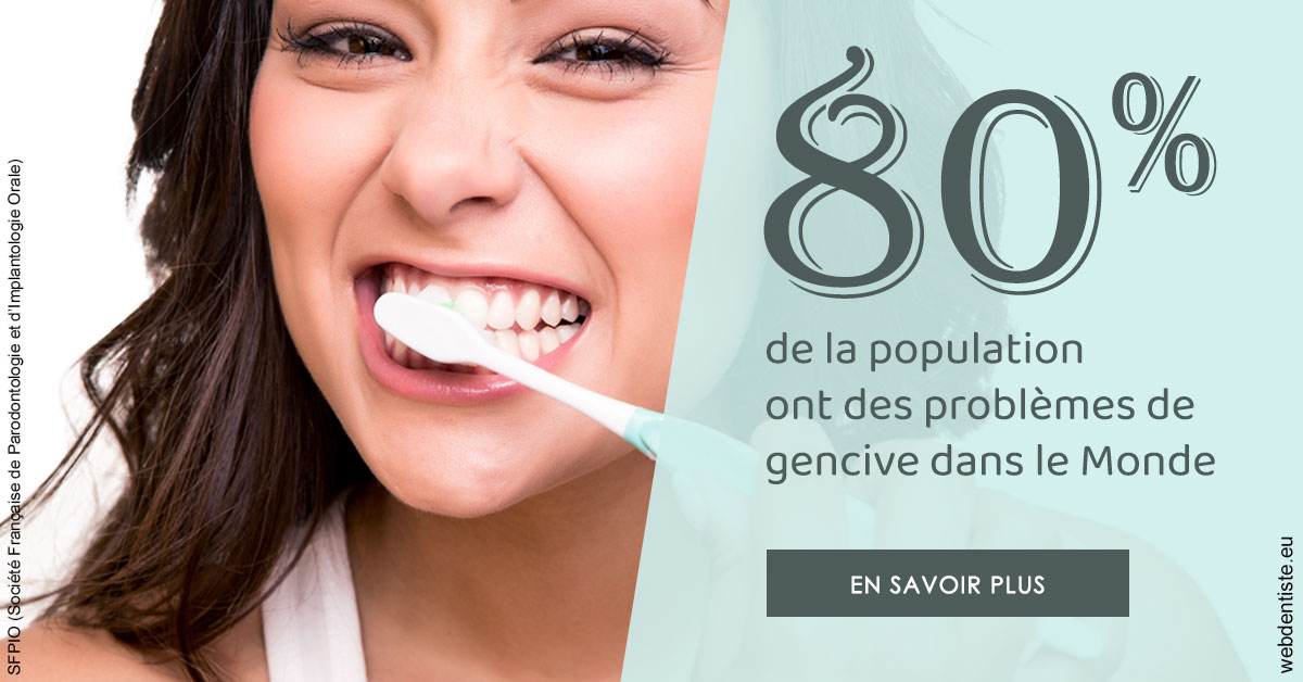 https://www.wilm-dentiste.fr/Problèmes de gencive 1